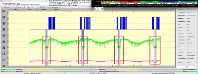 dxsatcs-amos-3-middle-east-sat-reception-prodelin-450cm-10722-mhz-v-Yes-israel-86H-signal-monitoring-FULL-000-with anomally-n